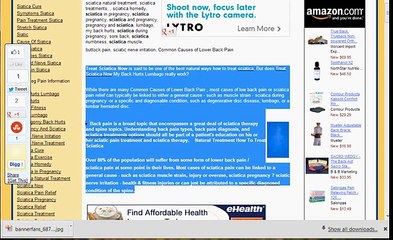 Treat Sciatica NOW Review