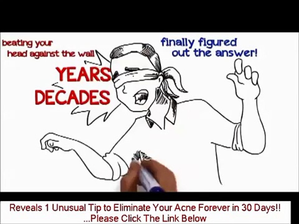 What Is In The Acne No More Book - Neutrogena Multi Vitamin Acne Treatment