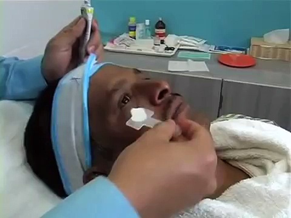 Skin Tags Removal at Oliva Skin Clinics - Hyderabad