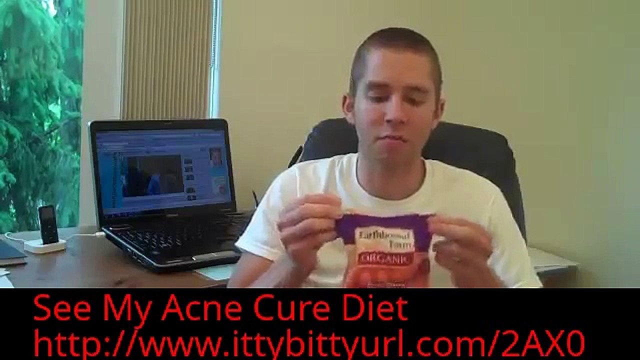 Chip's Tips For The Best Foods To Prevent Acne No More