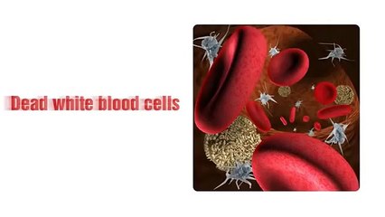 Acne No More Part 2 - The secrets to Curing Your Acne Holistically