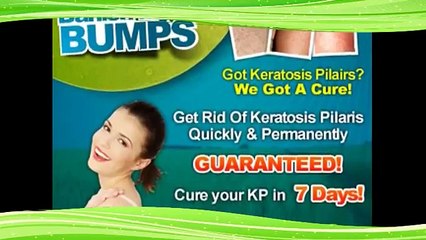 Banish My Bumps Keratosis Pilaris Cure