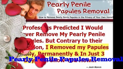Pearly Penile Papules Removal