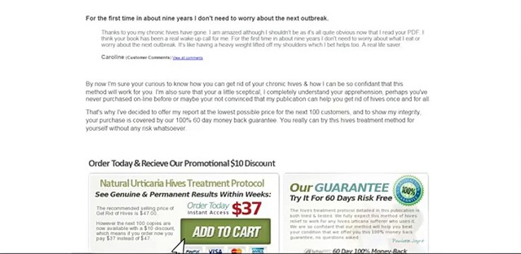 Get rid of hives – Natural urticaria,Hives Treatment