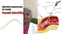 Female Fertility Treatments In Tamilnadu - Best Infertility Clinic In India