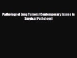 [PDF Download] Pathology of Lung Tumors (Contemporary Issues in Surgical Pathology) [Download]