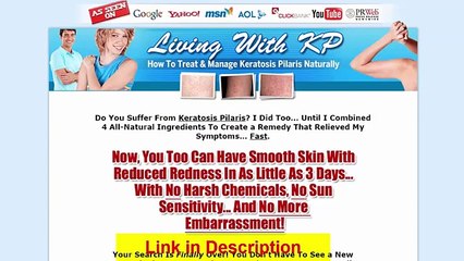Living With Kp Review - Get Rid Of Keratosis Pilaris Naturally