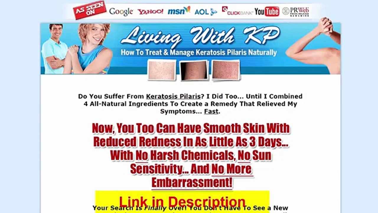 Living With Kp Review - Get Rid Of Keratosis Pilaris Naturally