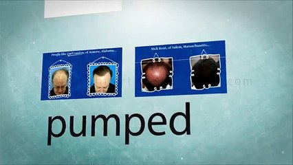 Hair Loss Protocol - My Review