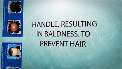 Hair Loss Protocol Review