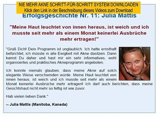 hormonelle akne loswerden - mike walden nie mehr akne buch download
