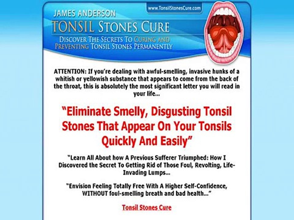 Tonsil Stones Cure Review & Discount