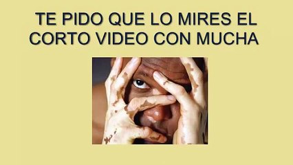 El Milagro Para El Vitiligo, David Paltrow