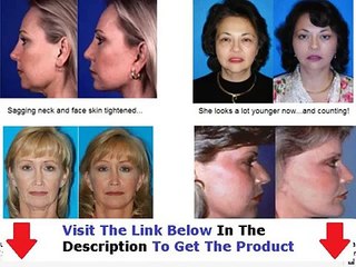 Facelift Without Surgery Review