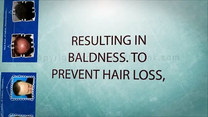 Hair Loss Protocol Program Review