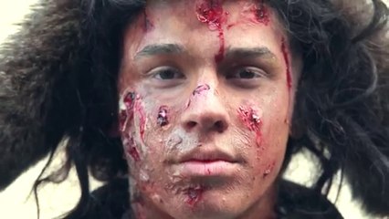 А Ты Помог Бы Прогнившему Бомжу _ Help To The Rotten Homeless