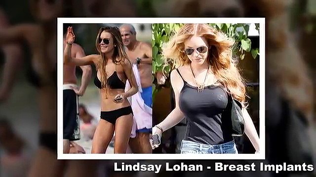 Celebrities Plastic Surgery transformations 2015 40 Stars Before After Plastic Surgery