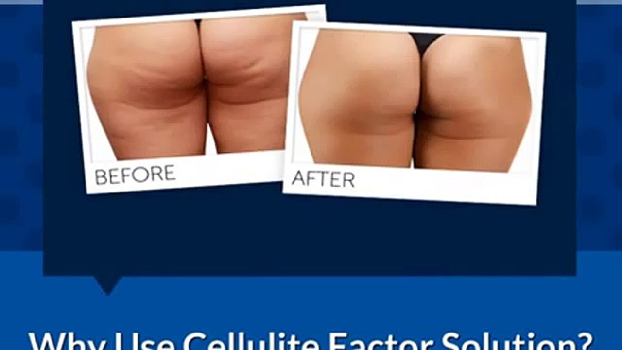Why Use Cellulite Factor Solution The Cellulite Guru  2015