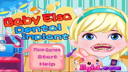 Baby Elsa Dental Implant - Frozen Games To Play - totalkidsonline