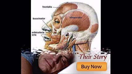 The Sleep Apnea Exercise Program Reviews-Know What&#39;s Good And Bad