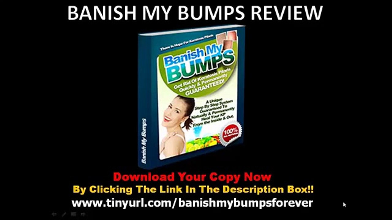 Banish My Bumps Review