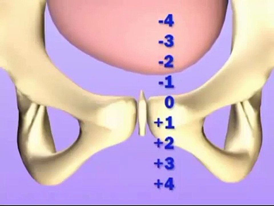 JJs Home Birth + Water Birth Part 1