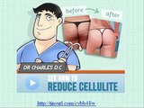 Cellulite Factor,Cellulite removal with Cellulite Factor
