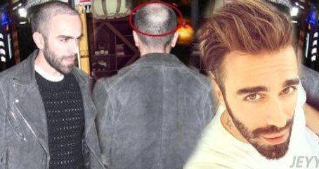 Kemal Doğulu'nun Saçlarına Ne Oldu?