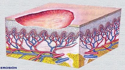 Celulitis Nunca Mas ® La Cura Natural por Mercedes Vila (Descargar)
