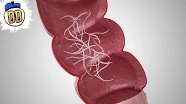 15 Parasites That May Be Inside You Right Now