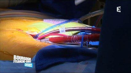 L'insuffisance cardiaque : chronique santé