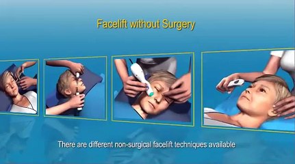 Facelift without Surgery