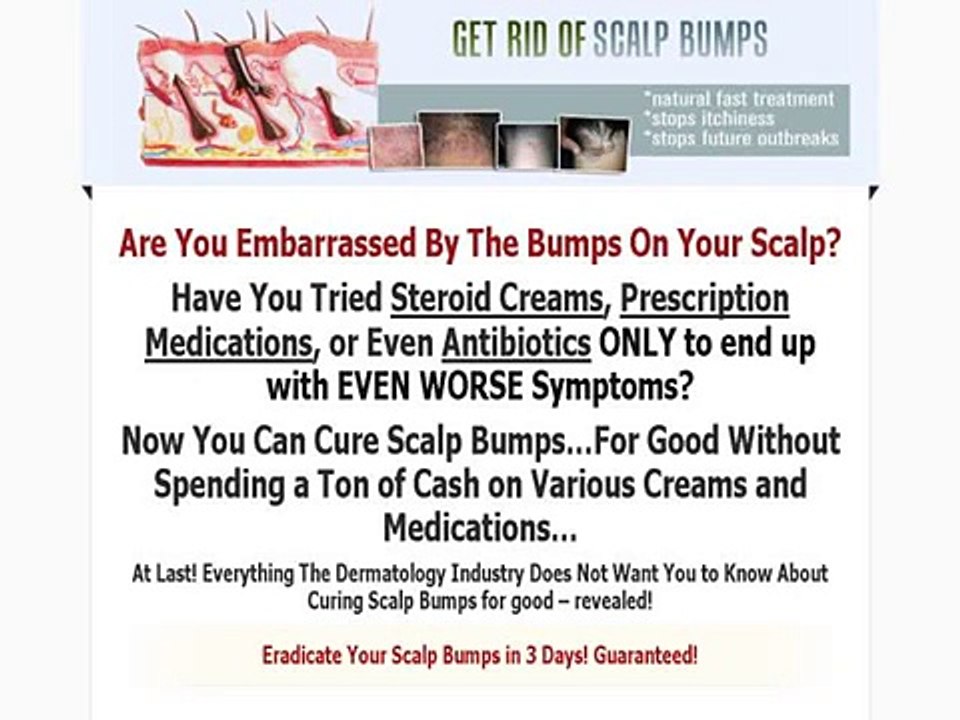 DISCOUNT PRICE Get Rid Of Scalp Bumps + FREE Mystery Bonus