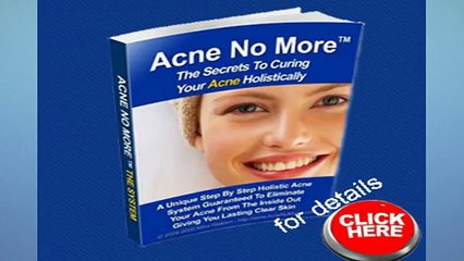 Acne No More Review-laser treatment for acne scars