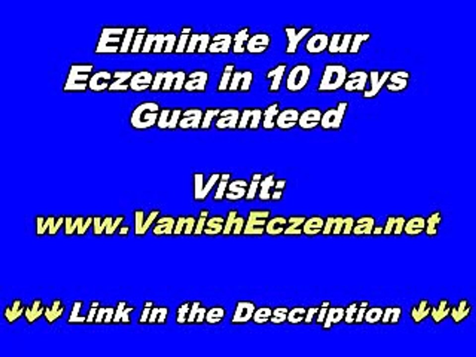Beat Eczema Review - How to Treat Eczema Easily?