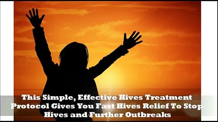 Get Rid Of Hives Forever - The Permanent Solution For Hives Treatment