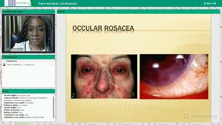 That's Not Blush.... It's Rosacea Webinar