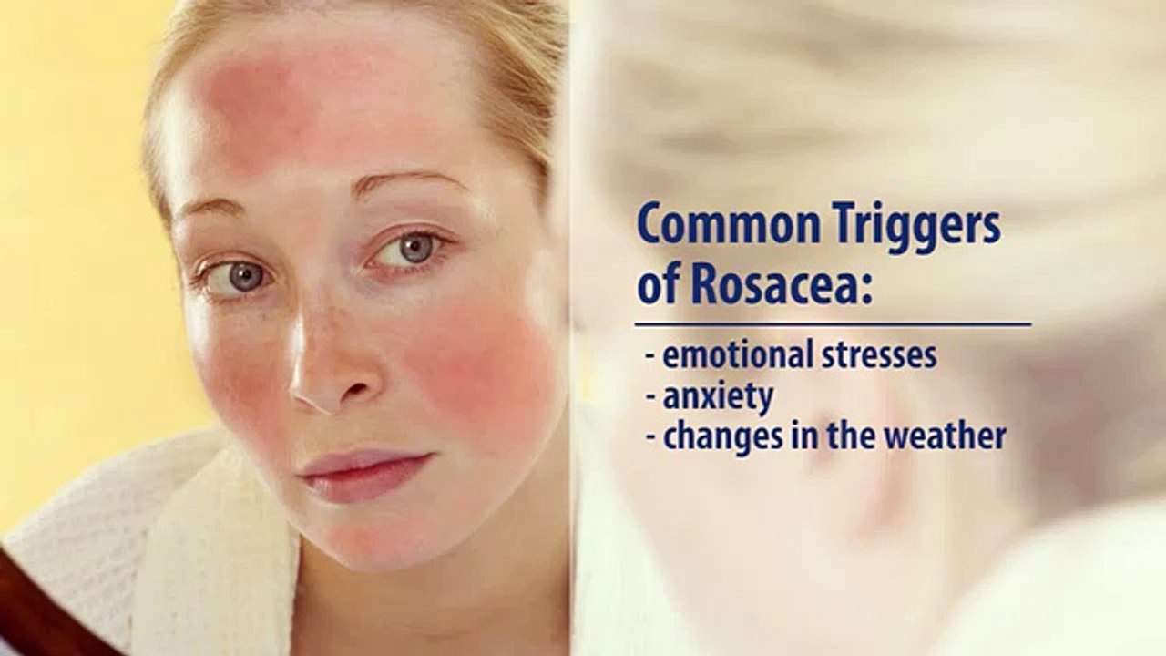 Rosacea | Dermatology Video Production