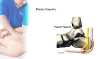 Secrets of Deep Tissue™: Plantar Fasciitis