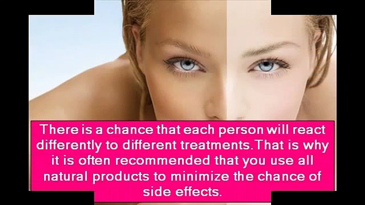 Skin Whitening Forever Review Does Work - Skin Whitening Forever Amazon