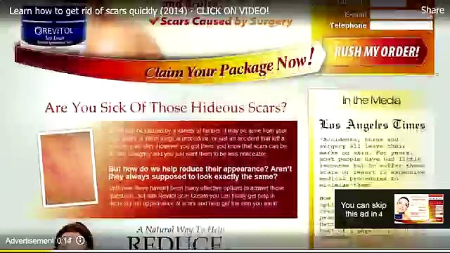 Rosacea – 10 Tips For Treatment [Rosacea Treatment]