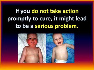 Heal   Eczema | Eczema Free Forever | A Guide How to Beat Eczema