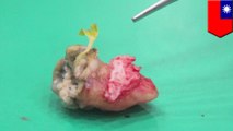 Dentist pulls gross 10-day-old guava sprout from man's wisdom tooth
