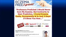 Eczema Free Forever Reviews-Does It Really Work?