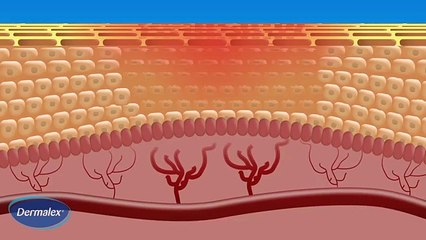 Dermalex Rosacea - How it works