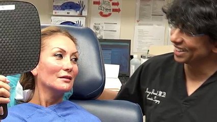Liquid Facelift without Surgery - a Y Lift Patient Review  - Performed by Dr. Amiya Prasad