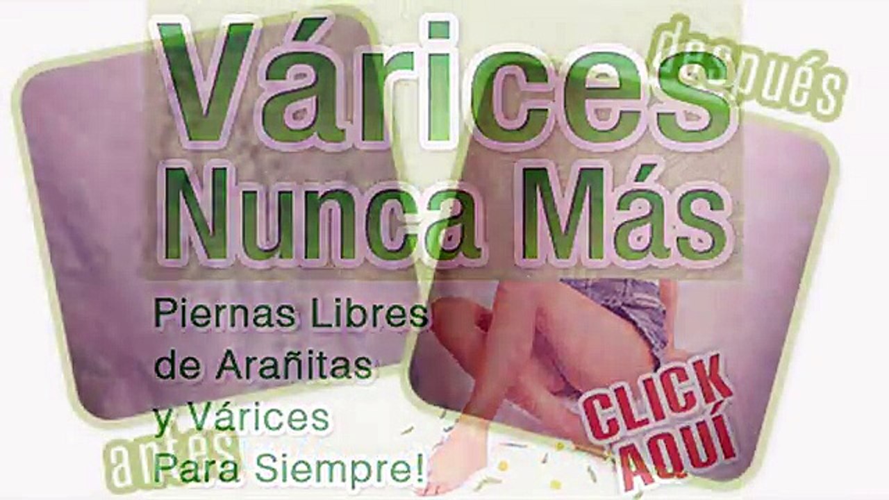 Varices Nunca Mas revisión  | Varices Nunca Mas ¿Estafa?
