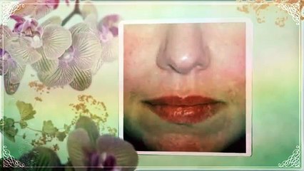 **Natural Rosacea Treatment**