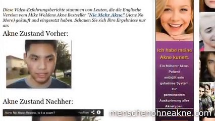 Ein Review Der von MenschenOhneAkne und "Nie Mehr Akne" Erfahrungen
