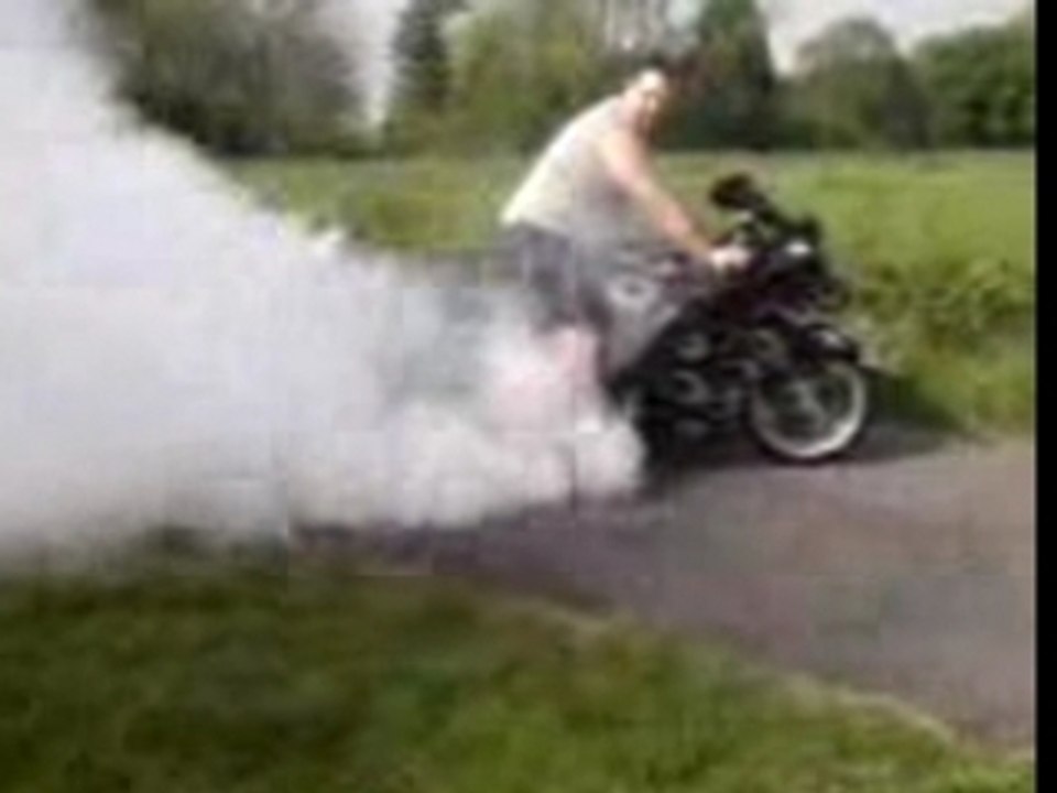 Burn 1100 xx